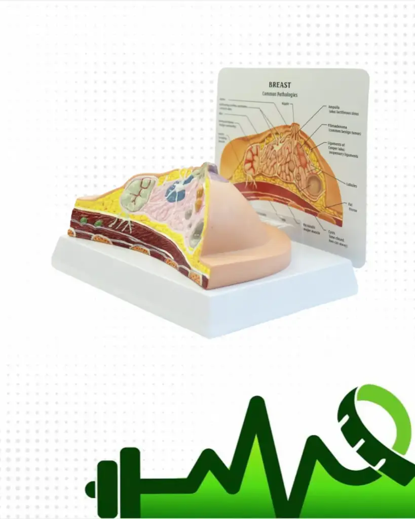 Modelo seno con patologías