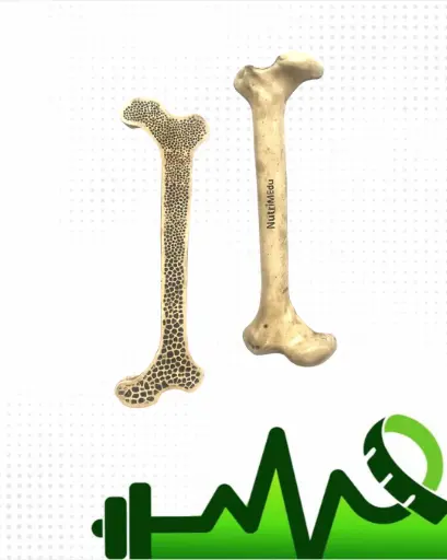 [MOP] Osteoporosis
